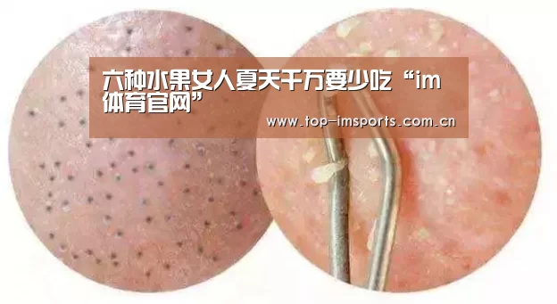 六种水果女人夏天千万要少吃“im体育官网”(图3) im体育官网